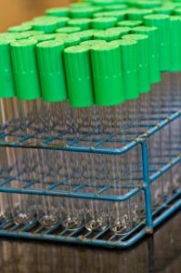 Ulga podatkowa dla krwiodawców